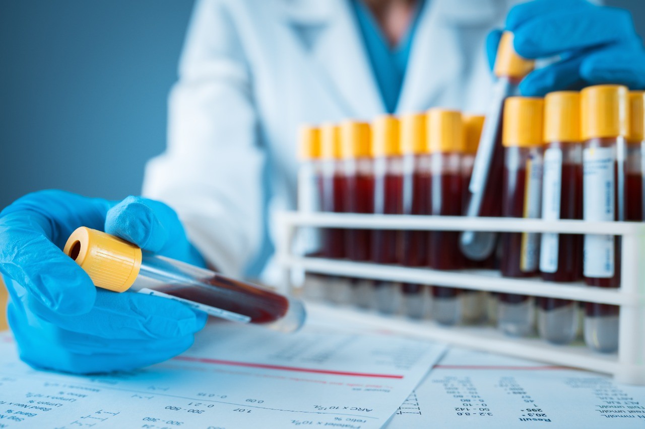 Diabetes Chal: prevención importante en jóvenes en costarricense

 – Noticias cr