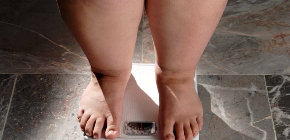 Obesidad Costa Rica: causas y consecuencias

 – Noticias cr