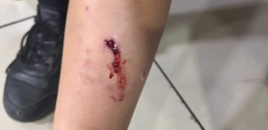 Entrevista con la Madre: propietarios del Pitbull que mordió a Minor en un centro comercial; El caso ya está en el OIJ

 – Noticias cr