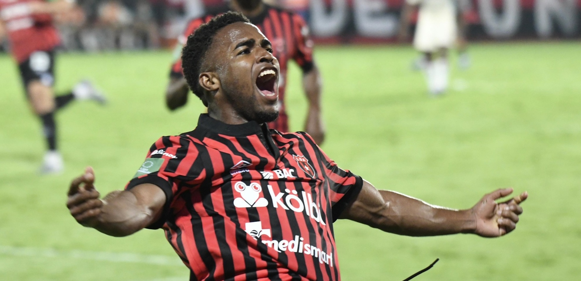 Alajuelas sufre importante pérdida para viajar a Honduras
 – Noticias cr