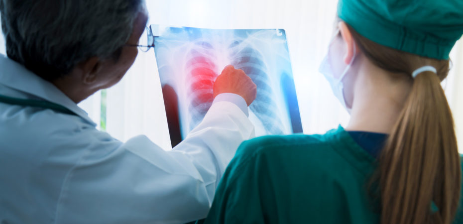 El 40% de los pacientes con cáncer de pulmón en Costa Rica nunca han fumado

 – Noticias cr