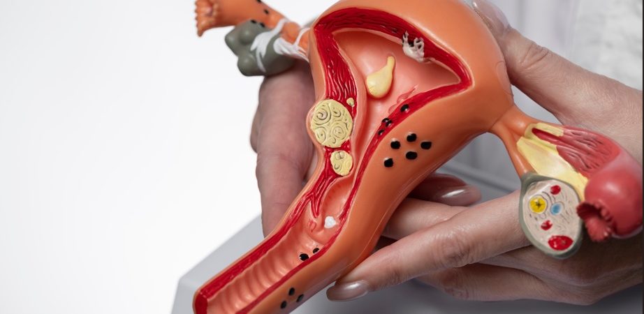 Costa Rica registra un aumento del 65% en casos de VPH: expertos advierten sobre riesgo de cáncer de cuello uterino

 – Noticias cr