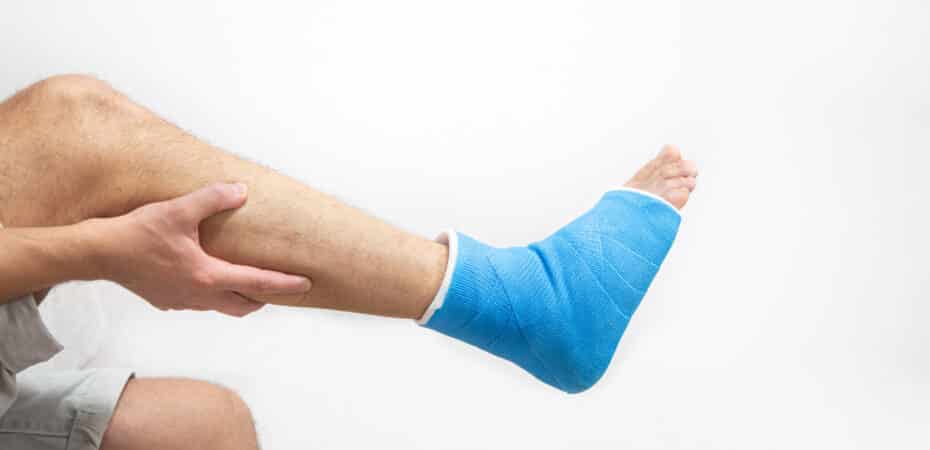 Fracturas de hueso y tobillo: las más comúnmente tratadas en la CCSS

 – Noticias cr